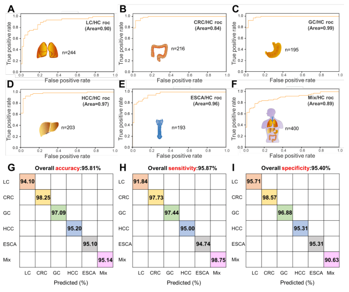 ROC curves with covariance matrices-assisted SVM model for distinguishing (A) 244 lung cancer patients, (B) 216 colorectal carcinoma patients, (C) 195 gastric cancer patients, (D) 203 hepatocellular carcinoma patients, (E) 193 esophageal carcinoma patien